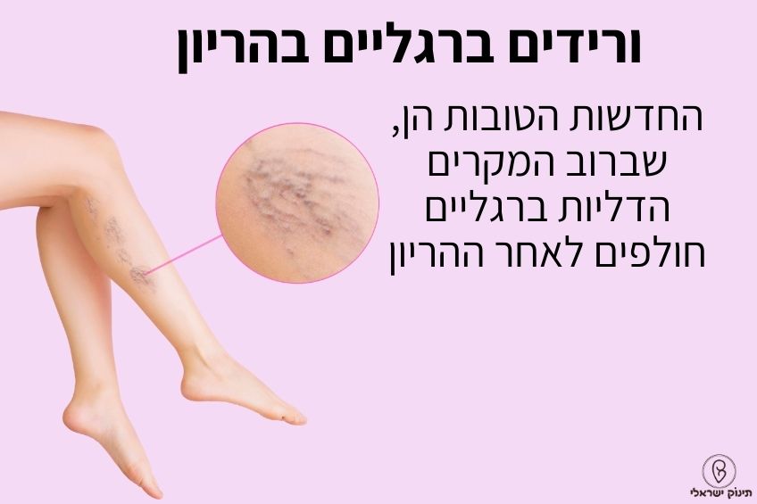 ורידים ברגליים בהריון