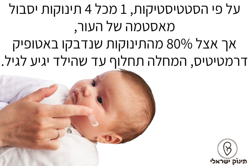 אטופיק דרמטיטיס תינוקות