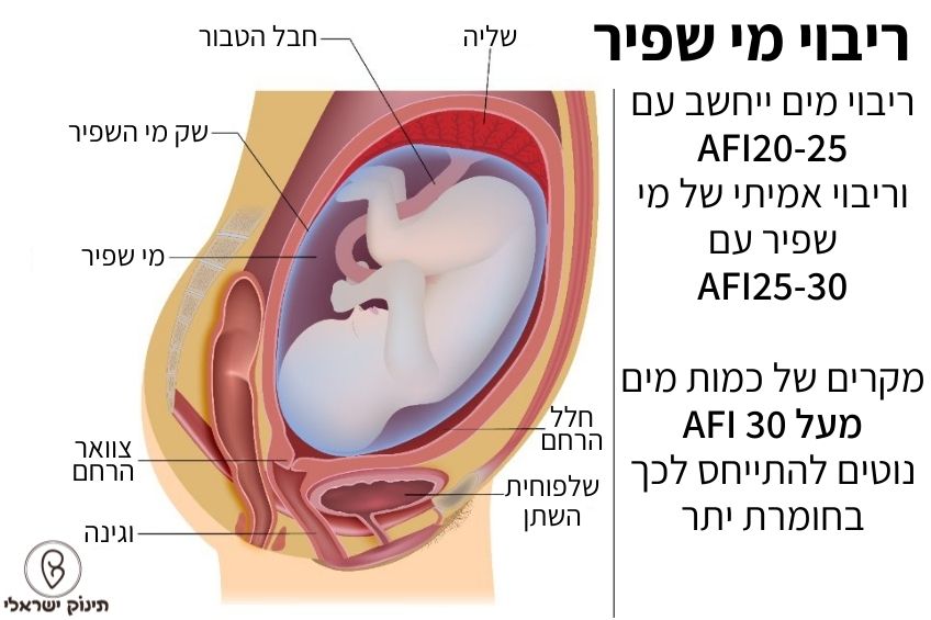 ריבוי מי שפיר