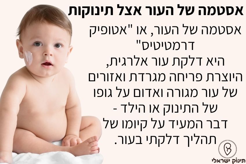 אסטמה של העור תינוקות אסטמה של העור תינוקות