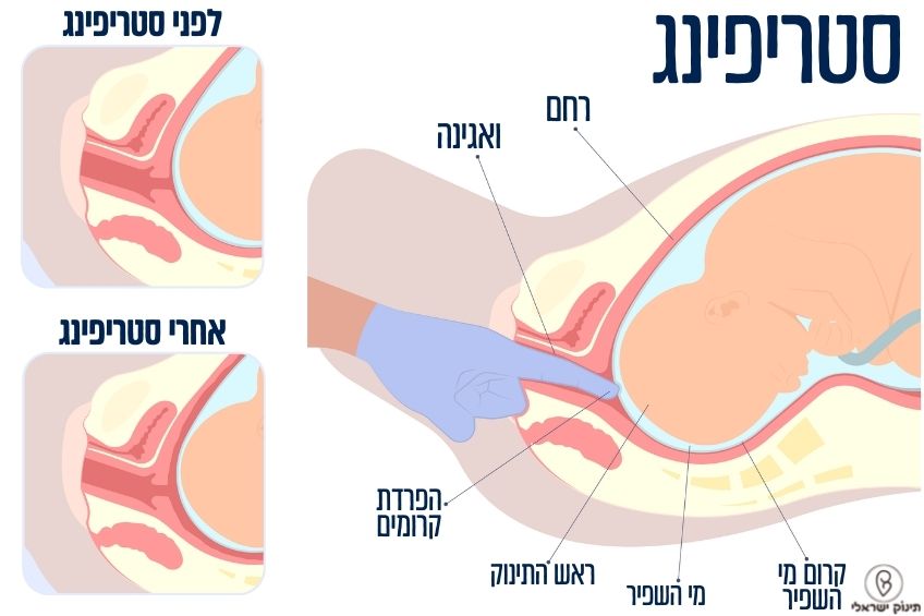 סטריפינג