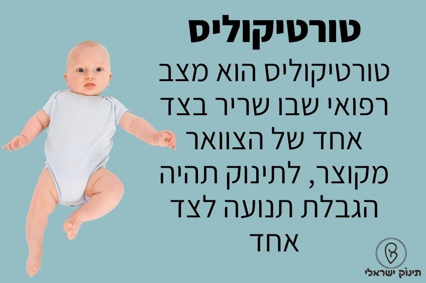 טורטיקוליס