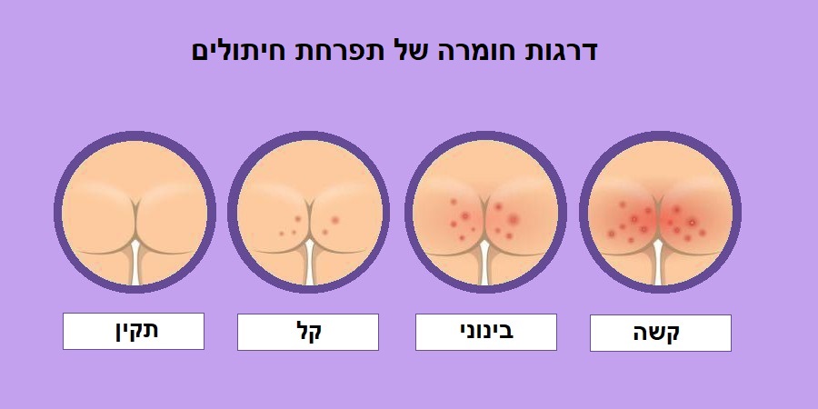 תפרחת חיתולים