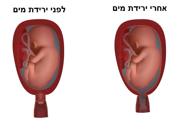 איך מזהים ירידת מים בהריון איך מזהים ירידת מים בהריון